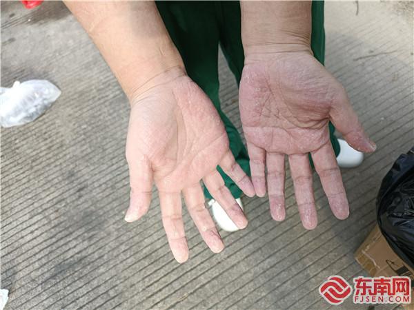 采樣結(jié)束后隊員們的手.jpg